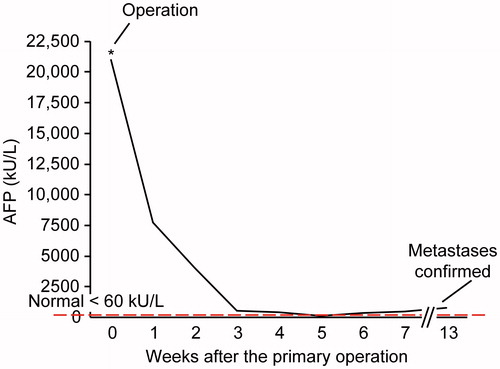 Figure 2. Time trends of the AFP levels in Pt #1 during the trajectory of his disease.