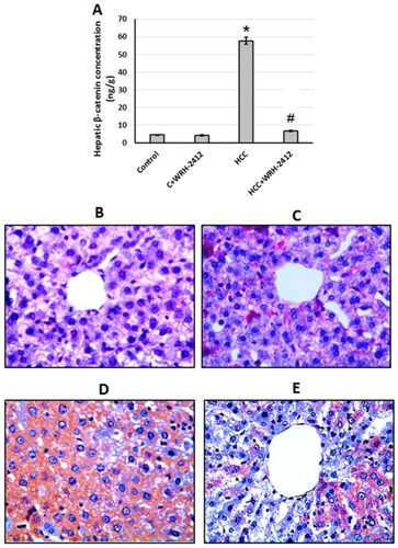 Figure 7. Effect of 5 mg/kg WRH-2412 on β-catenin protein levels (A) as well as liver sections stained with anti- β-catenin antibody in control group (B), control group treated with WRH-2412 (C), HCC group (D) and HCC group treated with WRH-2412 (E). *p < 0.05 vs. control; #p ≤ 0.05 vs. HCC group; HCC: hepatocellular carcinoma; C: control.