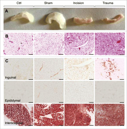 Figure 1. Surgical trauma induces adipose tissue browning. (A) Representative macroscopic morphology from paraffin embedded inguinal adipose tissues. From the left to the right: baseline, sham, incision and trauma group. (B) Representative H&E-stained inguinal adipose tissue sections which differentiated lipid droplets (white) from connective tissue (red). From the left to the right: baseline, sham, incision and trauma group. (C) Representative characterization of brown/beige adipocyte marker UCP1 by immunohistochemistry in inguinal (top), epididymal (middle), and interscapular (bottom) depots. Epididymal or white visceral and interscapular or brown fat represent negative and positive controls respectively. Data are representative of 10 independent animals per group. Bars represent 100 μm.