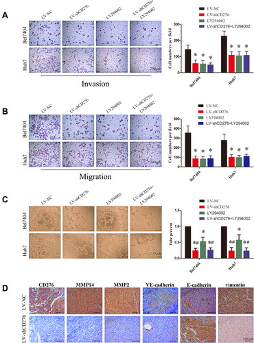 Figure 5 The activation of the PI3K/AKT/MMPs signaling pathway and EMT might be important mechanisms involved in CD276-promoting VM formation in HCC. (A) LY294002, a PI3K inhibitor, suppressed the invasion of HCC cells in vitro, just as CD276 knockdown did. The representative images and the quantification of the results are presented as mean ± SD; Scale bar represents 200μm (*p< 0.05). (B) Tanswell migration assay showed that LY294002 also suppressed the migration of HCC cells in vitro. The representative images and the quantification of the results are presented as mean ± SD; Scale bar represents 200μm (*p< 0.05). (C) LY294002 inhibited the tube formation of Bel7404 and Huh-7 cells in vitro, as CD276 knockdown did. However, the inhibitive effect of LY294002 alone on the tube formation is less favorable than using LV-shCD276 alone or in combination with LY294002. The representative images and the quantification of the results are presented as mean ± SD; Scale bar represents 200μm (*p< 0.05, compare to LV-NC treatment group, respectively; #p< 0.05, compare to LY292004 treatment group, respectively). (D) Immunohistochemical analysis showed that CD276 knock-down decreased the protein levels of MMP14, MMP2, VE-cadherin, vimentin, and increased the protein expression of E-cadherin in the orthotopic transplant mouse model of HCC cells.