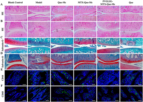Figure 7 Histology analysis of cartilage sections in CIA rats. (A) HE staining of knee joint sections after treatment, scale bar, 100μm. (B) HE staining of ankle joint sections after treatment, scale bar, 100μm. (C) Safranin O staining of knee joint sections after treatment, scale bar, 100μm. (D) Safranin O staining of ankle joint sections after treatment, scale bar, 100μm. (E and F) Images of immunofluorescence results of CD44 and CD68 in cartilage sections after treatment, scale bar=50 μm. Data are presented as the mean SD (n=6).