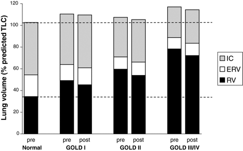Figure 1.  Pre- and post-bronchodilator static lung volumes are shown for each GOLD stage group compared with an age-matched healthy control group. Residual volume (RV) and functional residual capacity (FRC) increased progressively as GOLD stage worsened. Total lung capacity increased in GOLD stage I in conjunction with a preserved inspiratory capacity (IC), vital capacity (VC) and expiratory reserve volume (ERV). IC and VC then decreased progressively in GOLD stages II and III/IV.
