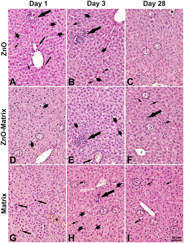 Figure 3. Examples of histological changes in the liver day of mice on 1 (A, D, G), 3 (B, E, H), and 28 (C, F, I) after intratracheal instillation of 2 µg/animal of ZnO (A–C), ZnO-Matrix (D–F), or Matrix (G–I). Long thick arrows: focal infiltration of inflammatory cells (note adjacent necrotic hepatocytes with distinct eosinophilic cytoplasm). Long thin arrows: necrotic hepatocytes (in A with eosinophilic cytoplasm, in G with pyknotic nuclei). Short thin arrows: prominent nuclei of Kupffer cells. Short thick arrows: binucleate hepatocytes. Circles: cytoplasmic vacuolation in hepatocytes. Asterisk: congestion. HE staining, magnification as on the scale in I. An example of a normal structure of the mouse liver is presented in Supplementary Figure S2(B).