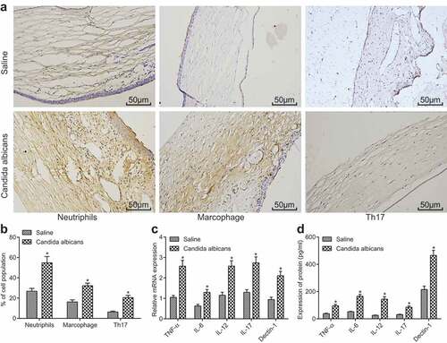 Figure 2. Mice with fungal keratitis present with increased inflammatory cytokine secretion and inflammatory cell infiltration. (a), The images of macrophages (F4/80 positive), neutrophile granulocytes (Ly6g positive) and Th17 (RORγ positive) in the Candida albicans group and the saline group (× 200); (b), The histogram of the positive cell rate of three different cell types; (c), The histogram of relative mRNA levels of different cytokines in each group; (d), The histogram of protein levels of different cytokines in each group; TNF, tumor necrosis factor; IL, interleukin; *, p < 0.05 vs. saline group; n = 12 in the saline group and n = 10 in the Candida albicans group; all data were measurement data, expressed as mean ± standard deviation and analyzed by t-test; the experiment was repeated for three times.