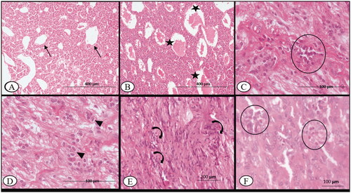 Figure 2. Bluetongue virus serotype-1 (BTV-1), 6 ml (5.5 log10 TCID50/ml) by I/D and IV routes, pregnant sheep at 60th gestation day. Pituitary sections: (A) at 7th DPI, showing normal capillary plexus (arrow) at C-7 DPI in the infected group, ×100; (B) at 7th DPI, showing dilated venous capillary (asterisk) plexus with blood, ×100; (C) mild infiltration of the lymphocyte (circle) in the pars nervosa of the pituitary observed at 14th DPI, H&E, ×400; (D) increased number of the pituicytes (arrowhead) observed in the pars nervosa of the pituitary, 14th DPI, H&E, ×400; (E) at 30th DPI, showing an increased number of pituicytes (curved arrow) with an enlarged nucleus in the pars nervosa, H&E, ×200 and (F) at 60th DPI, infiltration of the eosinophils (circle) between the glandular epithelium of anterior pituitary, H&E, ×400.