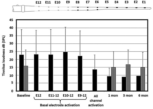 Figure 9. Psychoacoustic tinnitus loudness in dB at baseline and after CI with basal channels and complete CI stimulation for the CI group (black bars) and the control group (grey bars) [Citation27]. Statistical analysis: Wilcoxon signed-rank test (p < .05). Reproduced by permission of Elsevier B.V.