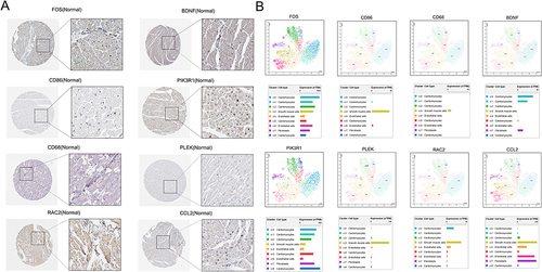 Figure 7 Subcellular localization of eight key genes. (A) The expression of the eight major genes for humans with normal cardiac tissue in the HPA database is determined by immunohistochemistry. (B) Transcriptome study of Single-cell for the eight major genes found in the HPA database.