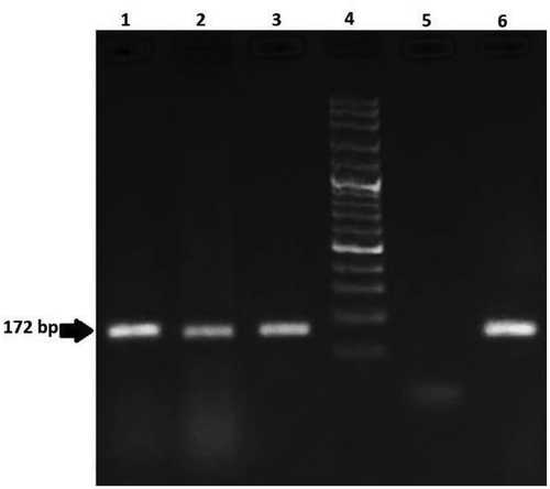 Figure 3. Agarose gel electrophoresis of PCR products from DNA of 3 soy samples for analysis of Roundup Ready (172 bp) line. Lanes 1–3: positive samples; Lane 4: 100 bp DNA ladder; Lane 5: negative control; Lane 6: positive control