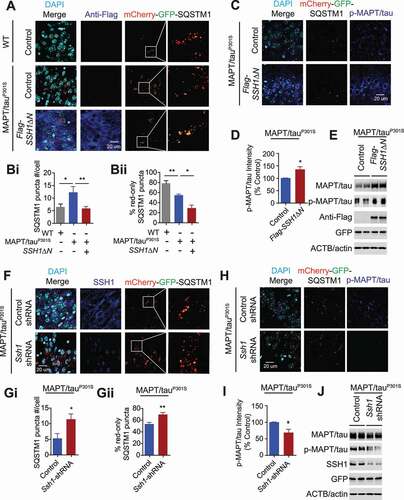 Figure 8. SSH1ΔN exacerbates and SSH1 reduction partially rescues SQSTM1 flux in MAPT/tauP301S brains. (A–D) 3-month old WT and MAPT/tauP301S mice co-injected with rAAV9-mCherry-GFP-Sqstm1 and rAAV9-Flag-control or Flag-SSH1ΔN and sacrificed 2 months post-injection at 5 months of age. (A) Representative images showing staining for Flag-M2 (dark blue) and DAPI (light blue) or direct fluorescence for mCherry-GFP-SQSTM1 (mCherry: red, GFP: green) in the hippocampus CA3 region. (B). Quantitative graphs of figure A expressed as means ± SEM, 1-way ANOVA: (Bi) F(2, 15) = 4.956, df = 2, P = 0.0223; (Bii) F(2, 15) = 24.86, df = 2, P < 0.0001, followed by Tukey’s posthoc test, n = 6 mice/condition *p < 0.05, **p < 0.005. (C) Representative images showing staining for p-S199/p-S202-MAPT/tau (dark blue) and DAPI (light blue) and direct imaging for mCherry-GFP-SQSTM1 (mCherry: red, GFP: green) in the hippocampus CA3 region of MAPT/tauP301S mice. (D) Quantitative graph of figure C (pS199/pS202-MAPT/tau) expressed as means ± SEM, 2-tailed t-test, P = 0.0117, n = 6 mice/condition *p < 0.05. (E) Representative blots of total MAPT/tau, p-S199/p-S202-MAPT/tau, Flag and GFP from dissected hippocampus of injected MAPT/tauP301S mice. (F-J) 3-month old MAPT/tauP301S mice co-injected with rAAV9-mCherry-GFP-Sqstm1 and rAAV9-control-shRNA or rAAV9-Ssh1-shRNA and sacrificed 2 months post-injection at 5 months of age. (F) Representative images showing staining for SSH1 (dark blue) and DAPI (light blue) or direct fluorescence for mCherry-GFP-SQSTM1 (mCherry: red, GFP: green) in the hippocampus CA3 region. (G) Quantitative graphs of figure F expressed as means ± SEM, 2-tailed t-tests: *P = 0.0224; (Gii), **P = 0.0044 (Gii), n = 6 mice/condition. (H) Representative images showing staining for p-S199/p-S202-MAPT/tau (dark blue) and DAPI (light blue) and direct imaging for mCherry-GFP-SQSTM1 (mCherry: red, GFP: green) in the hippocampus CA3 region of MAPT/tauP301S mice. (I) Quantitative graph of figure H (p-S199/p-S202-MAPT/tau) expressed as means ± SEM, 2-tailed t-test, *P = 0.0138, n = 6 mice/condition. (J) Representative blots of total MAPT/tau, p-S199/p-S202-MAPT/tau, SSH1 and GFP from dissected hippocampus of injected MAPT/tauP301S mice