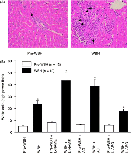 Figure 7. A section of liver tissues 15 h after WBH challenge. Inflammation was evidenced by inflammatory cell infiltration with hepatocytes degradation and necrosis (A, arrows). In the pre-WBH group, there were essentially no hepatocyte degradations or necrosis. Panel B shows the white cell count in liver histology under high power field. WBH challenge induced significant white cell sequestration in liver tissues (*p < 0.001). NOS inhibitors aggravated the white cells sequestration (*p < 0.05). However, NO precursor attenuated the cell sequestration (*p < 0.05, n = 12 for each group).