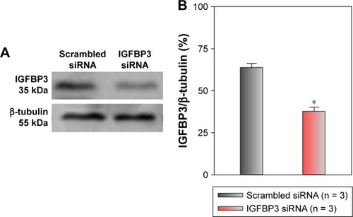 Figure 3 Effects of IGFBP3-specific siRNA on IGFBP3 expression in A431 cells.