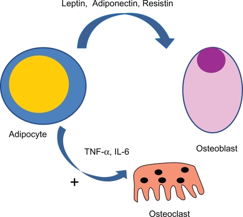 Figure 2 A complex link between adipocytes and bone cell exists. Several cytokines are secreted by fat tissue and act on bone cells. In particular, several proinflammatory cytokines (eg, IL-6 and TNF-α) act as osteoclastogenic factors with a potentially stimulating mechanism.