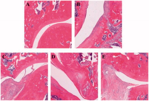 Figure 9. Typical histopathological images of knee joints illustrated the anti-inflammatory effects of title compound 3h on AIA rats: (A) normal; (B) AIA; (C) aspirin, 40 mg/kg; (D) compound 3h, 40 mg/kg; (E) compound 3h, 80 mg/kg. Aspirin was the positive control.