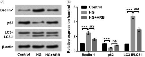 Figure 3. ARB inhibited HG-induced HK-2 cells autophagy. HK-2 cells were disposed with high glucose (HG, 45 mM) and 50 μM ARB, (A) autophagy associated proteins by western blot assessment following with (B) the relative density analysis in HK-2 cells. HG vs Control: ***p < .001; HG + ARB vs HG: ###p < .001; ns: no significant difference.