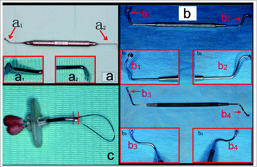 Figure 1. (A) The umbrella-shaped sinus lift curette YSL-04 (MCT company). Inserted images showed the tips; (B) The probe-improved sinus lift curettes (designed and fabricated by the corresponding author of this paper). Inserted images showed the tips (b1 and b2 were used for detaching sinus mucosa in mesiodistal directions; b3 and b4 were used for detaching sinus mucosa in buccal-palatal directions); (C) The shape-memory Ni/Ti alloy wire containing tube elevator (elevator 014, invented and fabricated by the corresponding author of this paper) showing the primary detaching knife (the part between the 2 red lines in the picture).