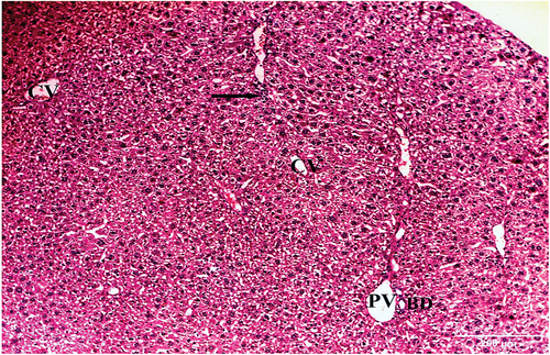 Figure 9. A photomicrograph of a liver section of HCC animals treated with IQ (20 mg/kg bw) showing central veins (CV), portal vein (PV), and bile ductule (BD). Hepatocytes with moderately vacuolated cytoplasm and mild inflammatory infiltrate (arrow) are also seen (H&E x100). figure (10) A photomicrograph of a liver section of HCC animals treated with IQ (20 mg/kg bw) showing central vein (CV), blood sinusoids (S), hepatocytes (H) with moderately vacuolated cytoplasm, and central rounded nuclei (N). Kupffer cells (K) are also seen (H&E x400).