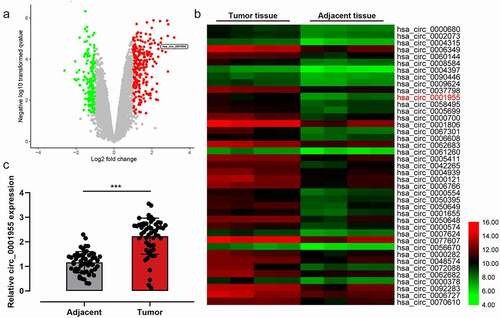 Figure 1. Circ_0001955 expression characteristics in NSCLC.