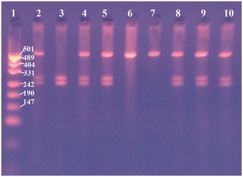 Figure 1. PCR-RFLP analysis of c.8514C > T osteopontin gene in cattle using BseNI endonuclease. Line 1 – pUC19 DNA/MspI marker, line 2 – CT genotype, line 3 – CC genotype, line 4 – CT, line 5 – CT, line 6 – TT, line 7 – TT, line 8 – CT, line 9 – CT and line 10 – CT.