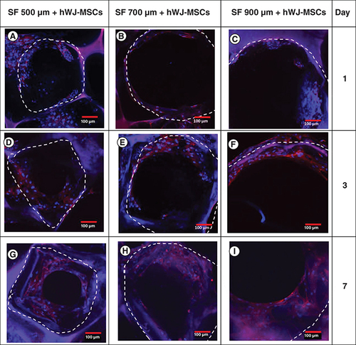 Figure 4. Pore filling trend of human Wharton jelly’s mesenchymal stem cells grown in a variation of pore diameters (3.5 mm scaffold thickness) as a function of incubation days.Confocal microscopy images of actin (red) and DAPI (blue) staining demonstrating the filling of SF scaffold pores by hWJ-MSC on: (A–C) day 1, (D–F) day 3, (G–I) and day 7, (A,D & G) with pore size variation of 500 μm; (B, E & H) 700 μm; (C,F & I) and 900 μm . The white dotted line marks the borders of scaffold porous structure.hWJ-MSC: Human Wharton jelly’s mesenchymal stem cells.Scale bar = 100 μm.