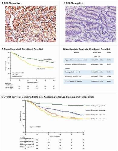 Figure 2. Relationship between CCL22 expression and overall survival among patients with gastric cancer in combined data set. Representative images showed that there existed CCL22-positive tumors (A) and CCL22-negative tumors (B) simultaneously. CCL22-positive tumors were associated with a lower rate of 5-year overall survival compared with those with negative CCL22 expression (C) and the result was validated by generating multivariate analysis based on cox proportional hazards regression model containing age, tumor size, tumor grade, tumor stage and CCL22 expression (D). The association between CCL22-positive tumors and a lower rate of 5-year overall survival was independent of pathological tumor grade (E).