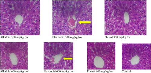 Figure 4. Histomicrogram of the liver of alkaloid, flavonoid and phenol extracts of S. acuta leaf in albino rats. (Arrow indicates central vein congestion at 300 mg/kg bw which was corrected at 600 mg/kg bw).