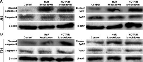 Figure S1 The effects of HOTAIR/HuR knockdown on cleaved-caspase-3 and PARP.Note: (A and B) The cleaved-caspase-3 and cleaved-PARP levels were evaluated in J82 and T24 cells with HuR/HOTAIR knockdown.Abbreviations: HOTAIR, HOX transcript antisense RNA; PARP, poly ADP-ribose polymerase.