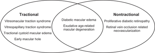 Figure 1 Schematic representation of mechanistic classification of vitreomacular adhesion-related disease