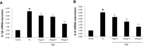 Figure 4 Sal down-regulated the expressions of IL-1β, IL-6 in L02 cells treated with PA.