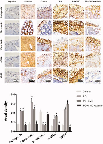 Figure 6. Immunohistochemistry is shown to analyze indicators of PF. The experimental results were consistent with western blot. *p < 0.05 versus control, #p < 0.05 versus PD.