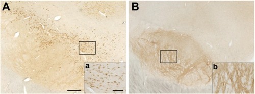 Figure 3 Distribution of α-synuclein-ir varies in the substantia nigra. Representative images of α-synuclein immunostaining in nigral cell bodies (A, a) or fibers (B, b). Scale bar: (A and B) =500 μm; (a and b) =50 μm.