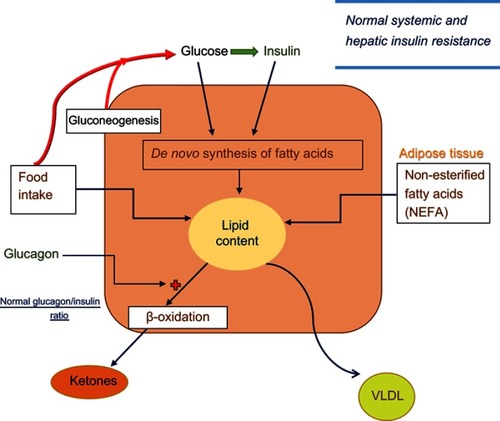 Figure 1 Lipid synthesis and deposition in hepatocytes in normal individuals. Blood glucose level is determined by food intake and endogenous glucose production from hepatic gluconeogenesis and glycogenolysis. Systemic and hepatic insulin resistance is normal. Increased glucose levels stimulate insulin secretion and increase blood insulin levels. Glucose and insulin each stimulate a cascade of metabolic events in liver to increase de novo fatty acid and cholesterol synthesis. In addition, hepatic lipid content is directly related to quantity and composition of food, and uptake of circulating non-esterified fatty acids released from adipose tissue. On the other hand, hepatic beta-oxidation (and ketogenesis) that can be activated by glucagon, and export of very low-density lipoprotein (VLDL) are the main mechanisms through which liver fat content is decreased. Blood glucagon/insulin ratio is normal.