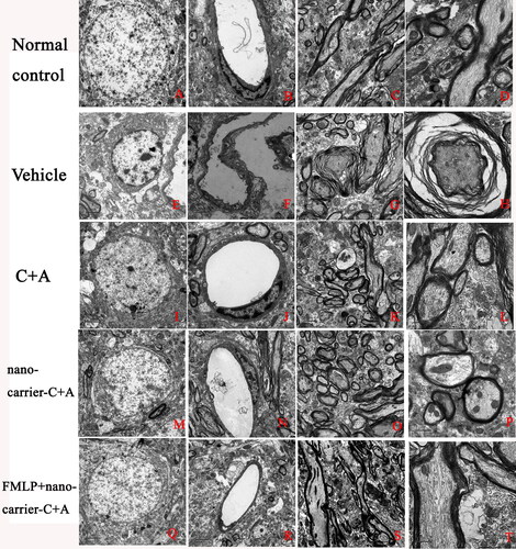 Figure 7. Representative images of electron micrographs showing that C + A compounds reduced demyelination, axonal loss, and neuronal apoptosis. A–C,E–G,I–K,M–O,Q–S, Scale bar =2 μm. D, H, L, P, T), Scale bar =1 μm.