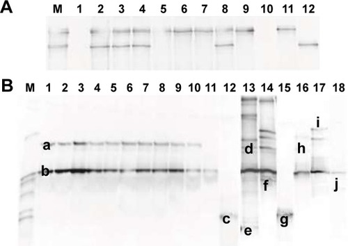 Figure 1 DGGE gel images of mutation analysis of EGFR exon 19.