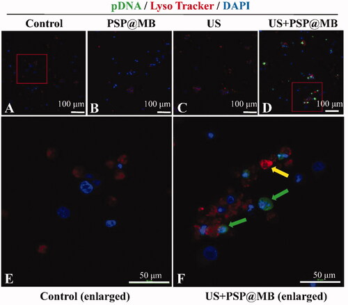 Figure 7. Gene intracellular delivery and endosomal escape effect of ultrasound combined with PSP@MB. Representative confocal microscopy images of FITC-labeled pDNA (green) and Lyso Tracker labeled lysosomes (red) in OCSCs 8 h after sonication. (A) Control group, (B) PSP group, (C) PSP@MB group, (D) US + PSP@MB group, (E) enlarged figure from Control group, and (F) enlarged figure from US + PSP@MB group. The yellow arrow indicates co-localization of pDNA and lysosomes. The green arrow showed that ultrasound combined PSP@MB promoted pDNA endosomal escape.