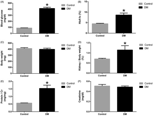 Figure 1. Effect of diabetes on biochemical parameters in vivo. Diabetes increased levels of blood sugar (A), HbA1c (B), kidney/body weight (%) (D) and urinary protein/Cr (E) in experimental animals. Diabetes mildly but no significantly attenuated body weight (C) and no significantly difference in serum Cr level (F) between these two groups. Rats were given STZ to induce diabetes. Symbol * indicates significant difference from the normal group (p < 0.05).
