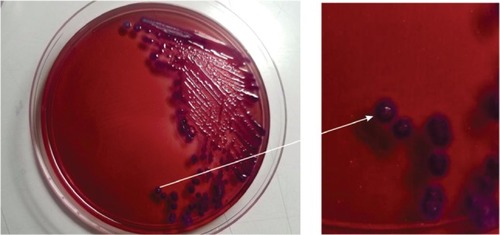 Figure 2 Morphology of B. pseudomallei colonies on ash down agar after 48 hours incubation at 37°C.