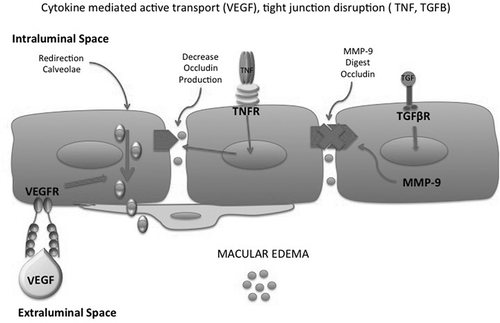 Figure 2a. Cytokine-induced mechanisms of macular edema. VEGF activates active transport of caveolae, TNF redistributes occludin with a relaxation of tight junctions, TGF beta induces MMP-9 which degrades occludins.VEGF-Vascular endothelial growth factor VEGF- Vascular endothelial growth factor TNF- Tumor Necrosis Factor TNFR-Tumor Necrosis Factor ReceptorMMP-9- Matrix Metallo Proteinase −9TGFB-Transforming Growth factor Beta TGFBR-Transforming Growth factor Beta Receptor.