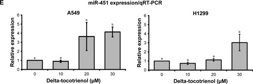 Figure 3 δT inhibits MMP-9 activity and expression via the inhibition of Notch-1, NF-κB, and uPA.