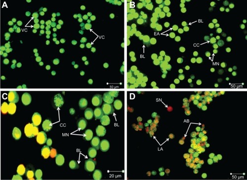 Figure 2 Fluorescent micrograph of acridine orange/propidium iodide double-stained Jurkat cells treated with the ZER-NLC. (A) Untreated cells showing a normal structure. (B) Early apoptosis of cells after 24 hours of treatment showing intercalated bright green staining with a marginated nucleus, chromatin condensation, and blebbing. (C) Blebbing, chromatin condensation, and nuclear margination after 48 hours of treatment. (D) Late apoptosis of cells after 72 hours of treatment showing reddish-orange staining with apoptotic body formation. Secondary necrotic cells displayed a reddish nucleus with an intact structure (400× magnification).Abbreviations: VC, viable cells; EA, early apoptotic cells; CC, chromatin condensation; MN, marginated nucleus; BL, cell membrane blebbing; AB, apoptotic body; LA, late apoptotic cells; SN, secondary necrotic cell; ZER-NLC, zerumbone-loaded nanostructured lipid carrier.