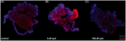Figure 6. In “in vivo” effects of spermidine on H3 acetylation\r\nImmuno-fluorescence analysis of Drosophila melanogaster polytene chromosomes: control (A) and after treatment with 3 μM (B) and 100 μM (C) spermidine.\r\n.