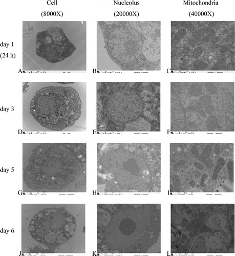 Figure 2. TEM (transmission electron microscopy) of primary broilers hepatocytes: cells (A,D,G,J), nucleoli (B,E,H,K) and mitochondria (C,F,I,L) at 24 h (A,B,C), day 3 (D,E,F), day 5 (G,H,I) and day 6 (J,K,L).