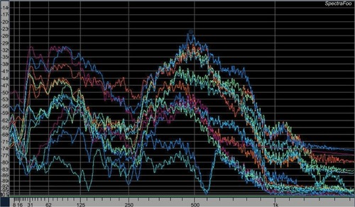 Figure 3 Frequency responses for each stethoscope.