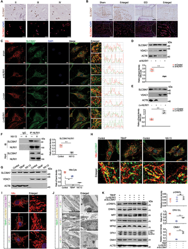 Figure 7. NLRX1 participates in modulating SLC39A7 trafficking at mitochondria that is essential for selective mitochondrial fission and mitophagy. (A and B) the expression of SLC39A7 in human different degenerative NP tissues (A) and rat disc degenerative models (B) examined by IHC and IF, human tissue scale bar: 25 μm (upper panel), 50 μm (lower panel), rat scale bar: 500 μm (upper panel), 500 μm (lower panel). (C) confocal analysis of MitoTracker labeling and SLC39A7 protein with if staining in primary human NP cells isolated from health NP tissues with NLRX1 knockdown or not (upper two panel), or from degenerated NP tissues with NLRX1 overexpression or not (lower two panel), scale bar: 10 μm. (D and E) protein lysates extracted specially in mitochondria and cytoplasm of human NP cells isolated from health NP tissues with NLRX1 knockdown or not (D), or from degenerated NP tissues with NLRX1 overexpression or not (E), followed by western blotting. (F) protein immunoprecipitated (IP) using anti-NLRX1 antibody from NP cells treated by NX-13 or not, followed by western blotting. (G) protein lysates extracted specially in mitochondria and cytoplasm of human NP cells treated by TBHP, NX-13 or not, followed by western blotting. (H) confocal analysis of MitoTracker labeling and SLC39A7 protein with if staining in primary human NP cells treated by TBHP, NX-13 or not, scale bar: 10 μm. (I and J) mitochondrial morphology analysis by fluorescence microscope with MitoTracker Red CMXRos label and transmission electron microscopy (TEM) in primary human NP cells isolated from degenerated NP tissues following the treatments of PBS or TBHP with NLRX1 overexpression, SLC39A7 knockdown or not, fluorescent scale bar: 5 μm, TEM scale bar: 2 μm (left panel), 500 nm (right panel). (K) protein expressions of mitochondrial dynamics indicators (p-DNM1L, DNM1L, MFF, MFN1, MFN2, OPA1, OMA1) in primary human NP cells isolated from degenerated NP tissues following the treatments of PBS or TBHP with NLRX1 overexpression, SLC39A7 knockdown or not. Data are represented as mean ± SD. *p < 0.05, **p < 0.01.