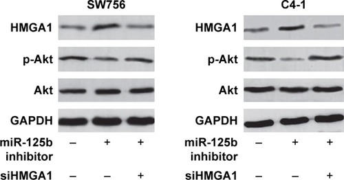 Figure 5 miR-125b regulated PI3K/Akt pathway through suppression of HMGA1. The primary Akt protein level was detected after co-transfection with miRNA inhibitor and siHMGA1 in SW756 and C4-1 cells.
