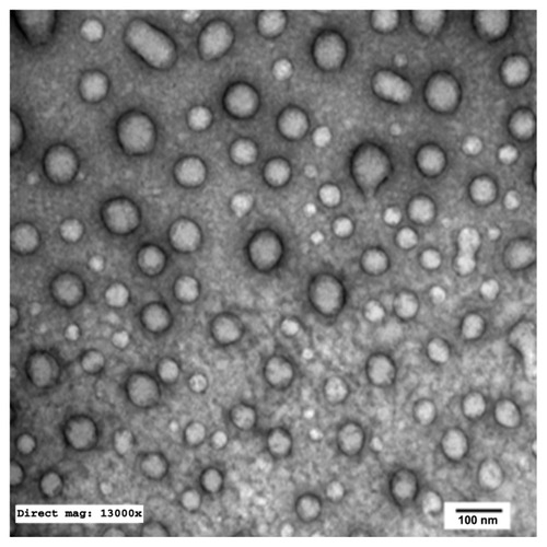 Figure 5 Transmission electron microscopy photograph of nonalkalinized self-nanoemulsifying system with 1000-fold dilution in distilled water (×13,000).