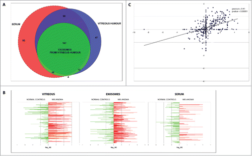 Figure 2. Comparison of miRNAs found in VH, VH exosomes and serum of UM and healthy controls. (A) Venn diagrams showing the overlap between miRNA sets found in different types of samples. (B) Quantitative representation of miRNA different expression between UM patients and controls in VH, VH exosomes, serum. (C) Correlation between RQs from VH and its exosomes: x-axis represents the −log10 of RQ of vitreal miRNAs in UM patients with respect to normal controls; y-axis represents the −log10 of RQ of exosomal miRNAs in UM patients with respect to normal controls.