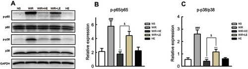 Figure 7 Effect of esomeprazole pretreatment on p38-MAPK and NF-κB activity after induction of stress ulcer induced by WIR.