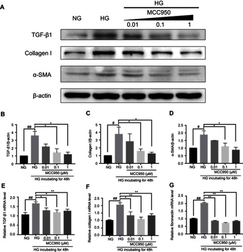 Figure 6 MCC950 decreased expression of fibrosis markers by inhibiting NLRP3 inflammasome activation in mesangial cells.