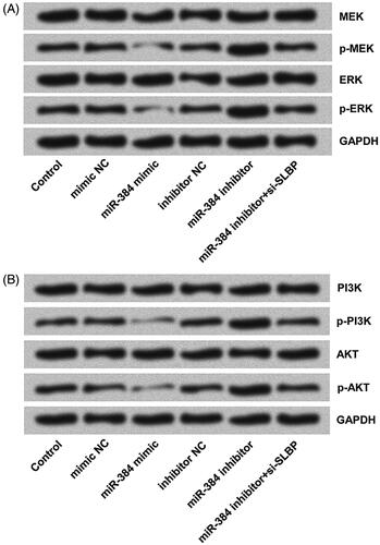 Figure 5. miR-384 silence activated (A) MEK/ERK and (B) PI3K/AKT signalling pathways in MG63 cells by up-regulating SLBP. However, miR-384 overexpression inhibited the activations of both pathways. MEK, ERK, PI3K and AKT, as well as their phosphorylated forms, were analyzed using Western blotting assay.
