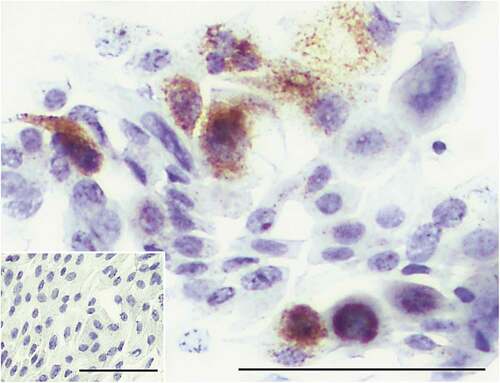 Figure 5. Immunohistochemical detection of S100A8/9.